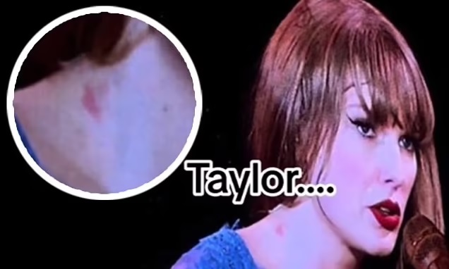 Taylor Swift appears to have a HICKEY on her neck during Stockholm concert after enjoying romantic getaway with boyfriend Travis Kelce