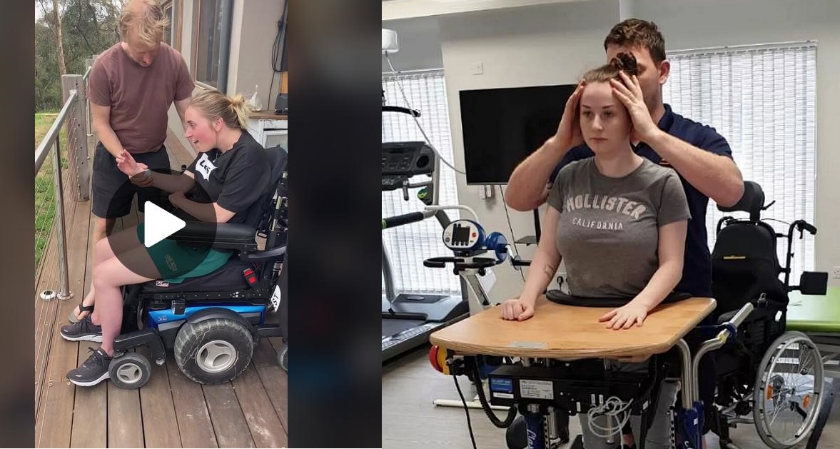 Watch touching video of Jade Almond, from Wigan, documentation of how she got support from parent and boyfriend and now she's able to stand without support after one year of accident that left her paralyzed